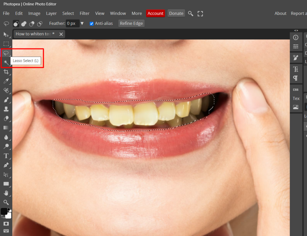A screenshot of Photopea working area showing the teeth area selected by a Lasso Select.